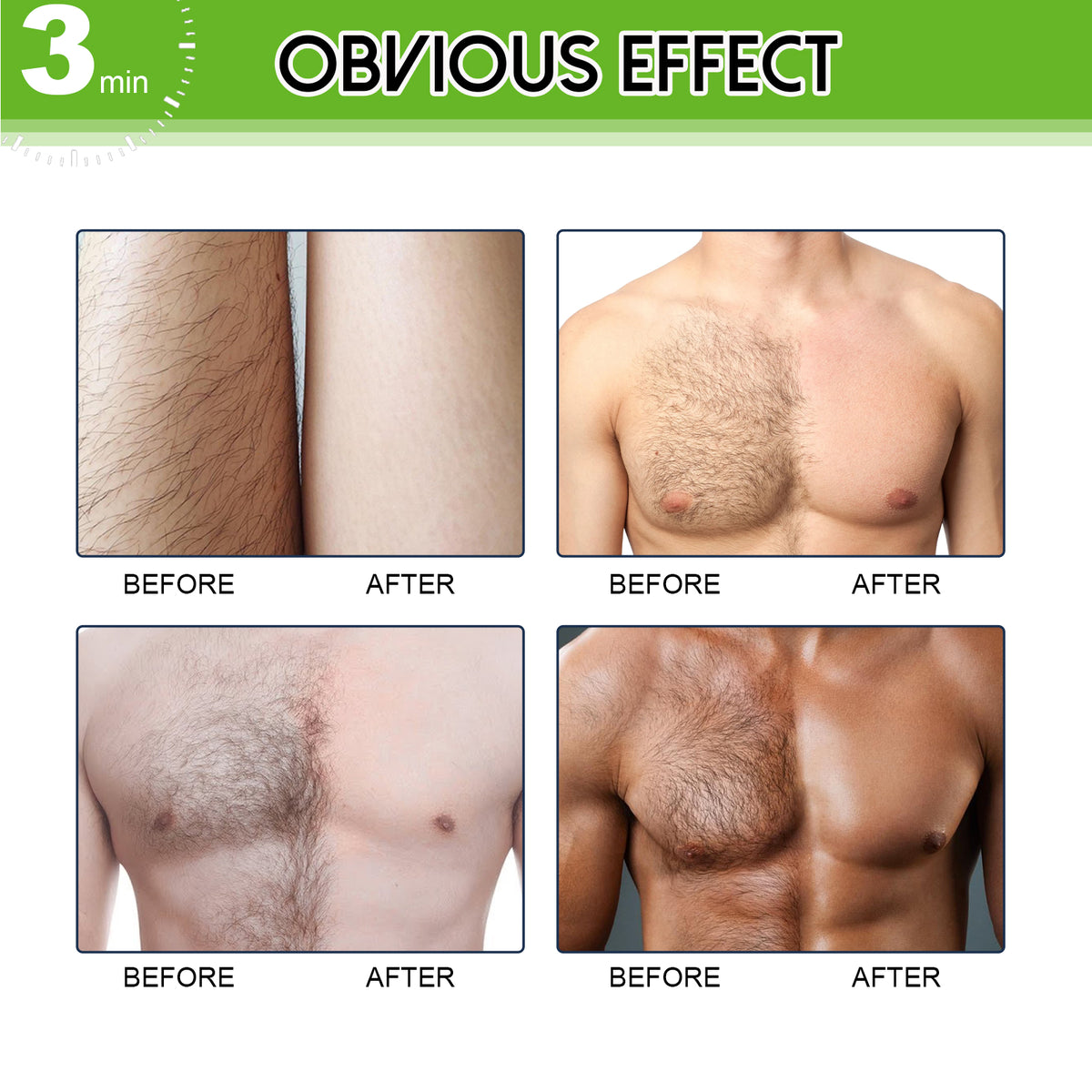 East Moon Hair Removal Cream For Men, Arms, Armpits And Legs Gentle And Non-Irritating Body Clean Skin Hair Removal Cream